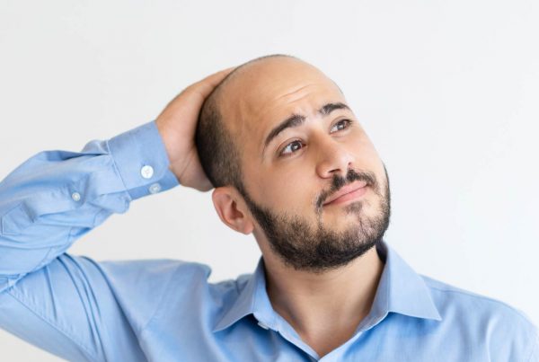 male pattern baldness